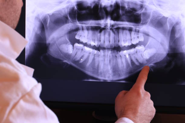 Best Broken Tooth Emergency  in Newport, NC