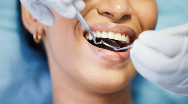 Best Chipped Tooth Repair Near Me  in Newport, NC