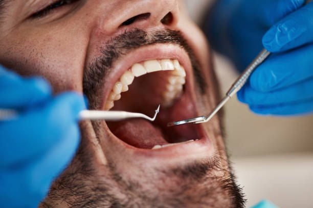 Best Root Canal Emergency Dentist  in Newport, NC