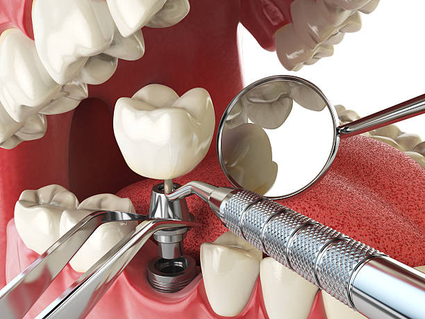 Best Urgent Tooth Repair  in Newport, NC